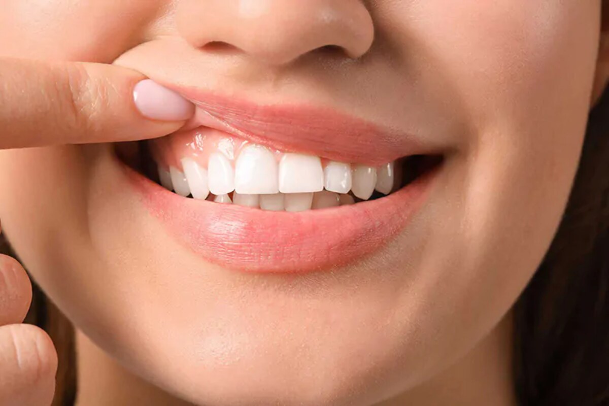 understanding gum grafting restore your healthy smile