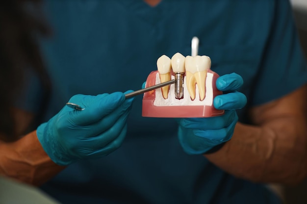 can dental implants prevent jawbone loss