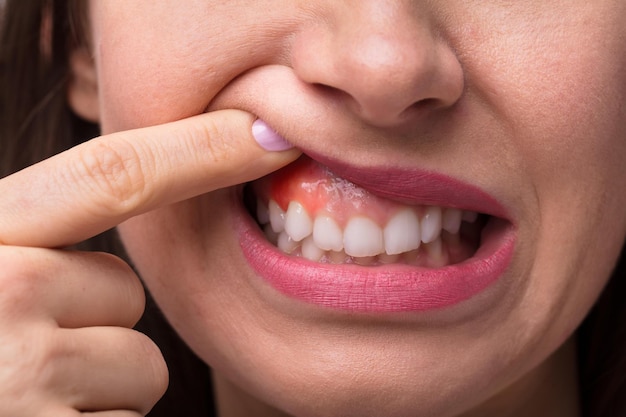 periodontal services help gum diseases